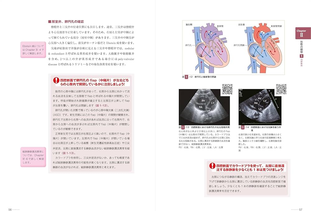 改訂2版 新生児の心エコー入門:超音波検査にもとづくNICU循環管理の
