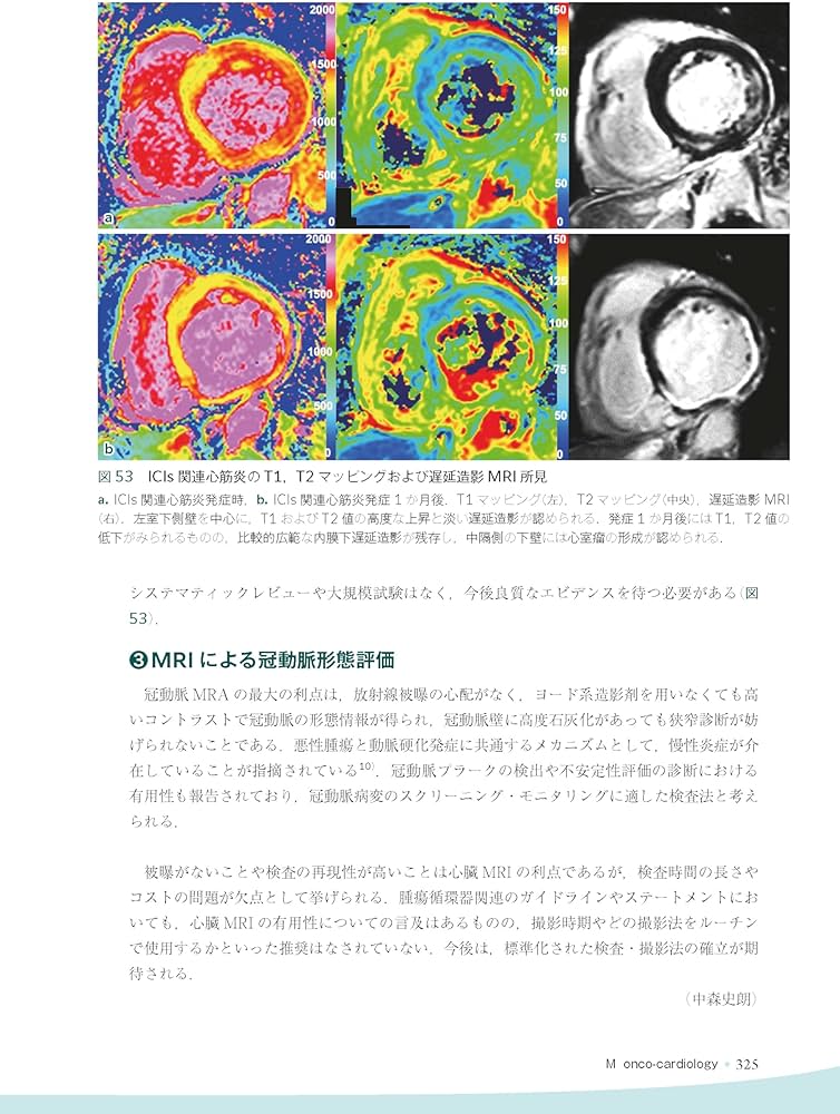 心臓疾患のCTとMRI 第2版 | 佐久間肇, 陣崎雅弘, 北川覚也, 石田正樹