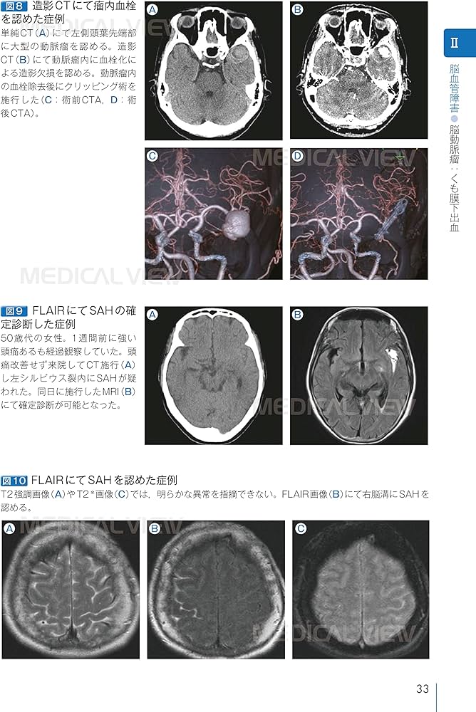 脳神経外科 周術期管理のすべて 第5版 | 松谷 雅生, 田村 晃, 藤巻