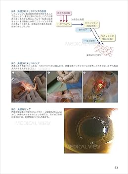 診断と治療 (眼科診療マイスター II) | 飯田 知弘, 中澤 徹, 堀 裕一