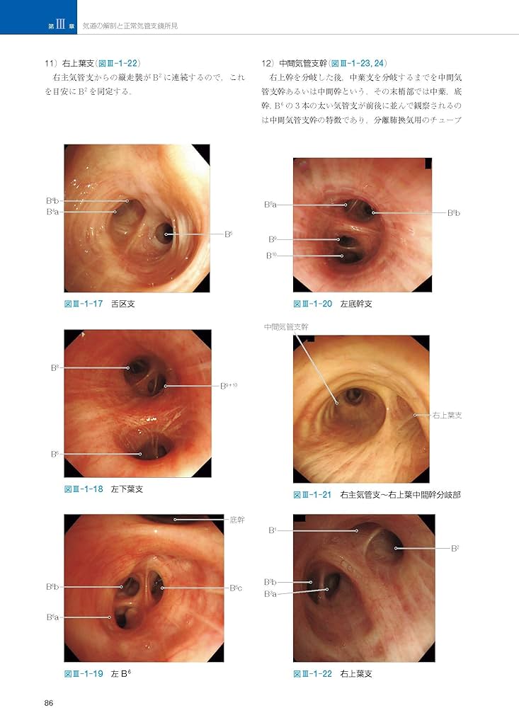 81JgbrbFnZL._AC_UF1000,