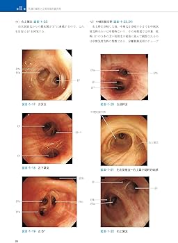 気管支鏡テキスト 第3版 | 日本呼吸器内視鏡学会 |本 | 通販 | Amazon