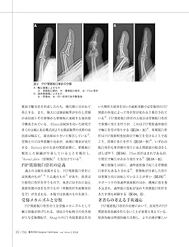 整形外科サージカルテクニック 2024年2号〈特集〉手部・指節骨骨折