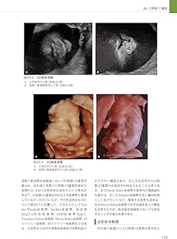 81L45PPQ5hL._AC_UF350,