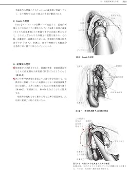 耳鼻咽喉・頭頸部手術アトラス[上巻] 第2版 | 森山 寛 |本 | 通販 | Amazon