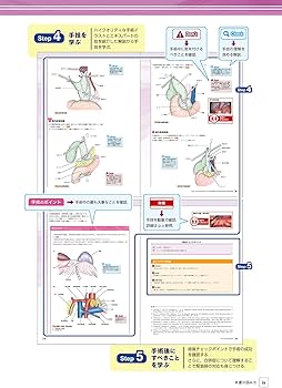 消化器腹腔鏡下手術 肝臓・胆道・膵臓・脾臓 (ビジュアルサージカル