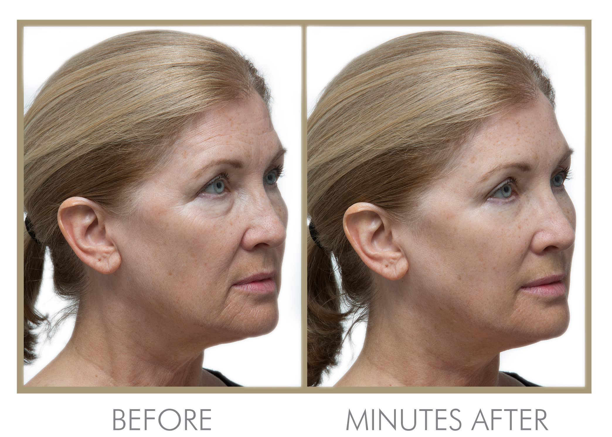 Amazon.com: GENIE Instant Line Smoother (30 ml/1 fl oz) : Beauty