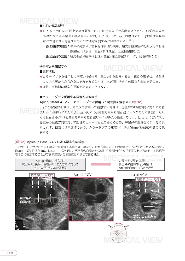 81ktI5S8jZL._AC_UF1000,