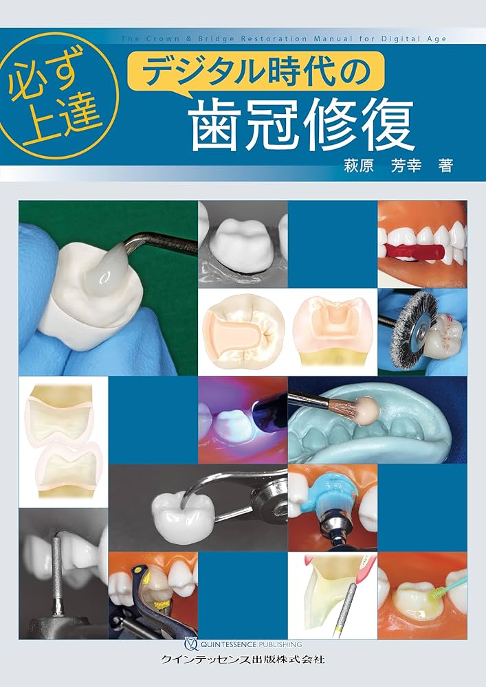 必ず上達 デジタル時代の歯冠修復 | 萩原芳幸 |本 | 通販 | Amazon