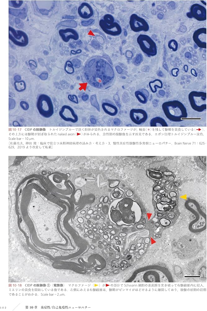 末梢神経病理：どう作り、どう読み、どう臨床に生かすか | 神田隆