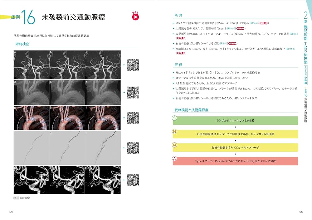 経橈骨動脈脳血管内治療（TRN）超入門：145本のWEB動画とイラストで