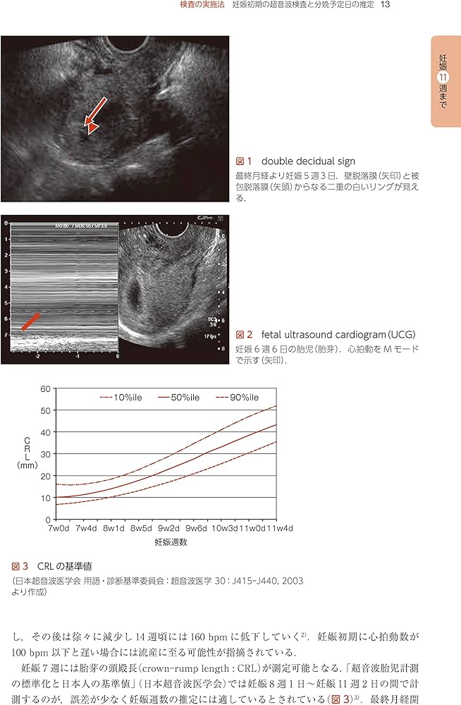 Amazon.co.jp: 週数別 妊婦健診マニュアル 第2版 : 藤井 知行: 本
