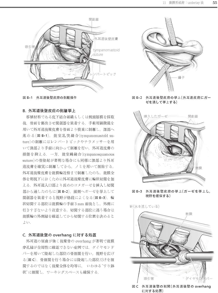 耳鼻咽喉・頭頸部手術アトラス[上巻] 第2版 | 森山 寛 |本 | 通販 | Amazon