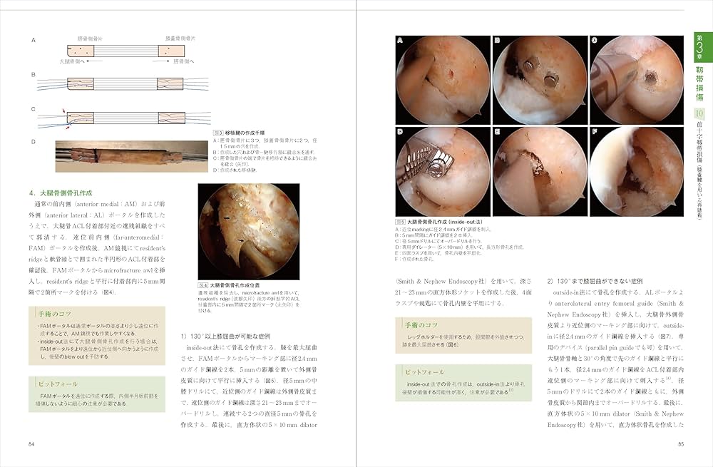 膝の外傷：診断・適応・手術 (整形外科SURGICAL TECHNIQUE BOOKS 14