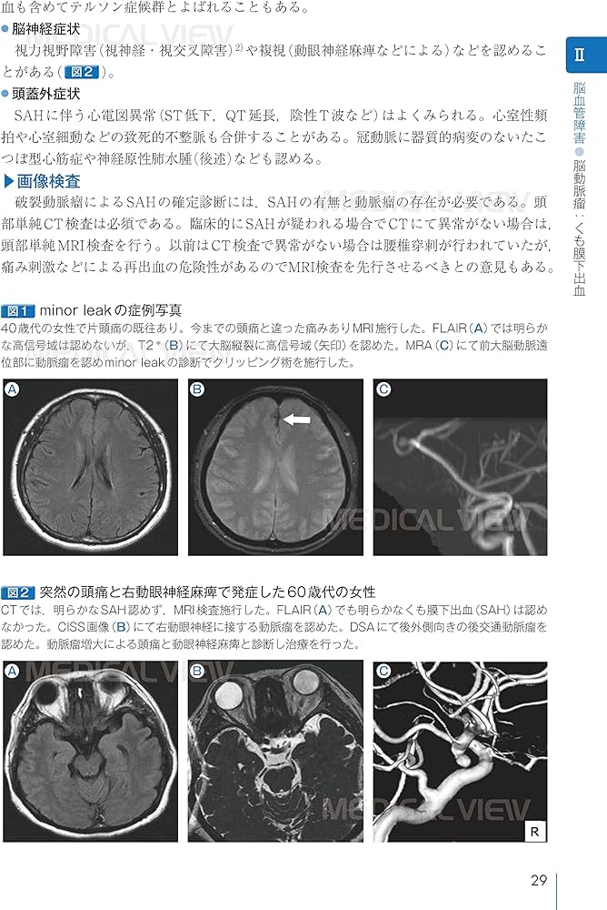 脳神経外科 周術期管理のすべて 第5版 | 松谷 雅生, 田村 晃, 藤巻