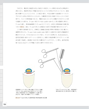 整形外科医のための脊椎のアドバンスト手術 | 石井 賢 |本 | 通販 | Amazon