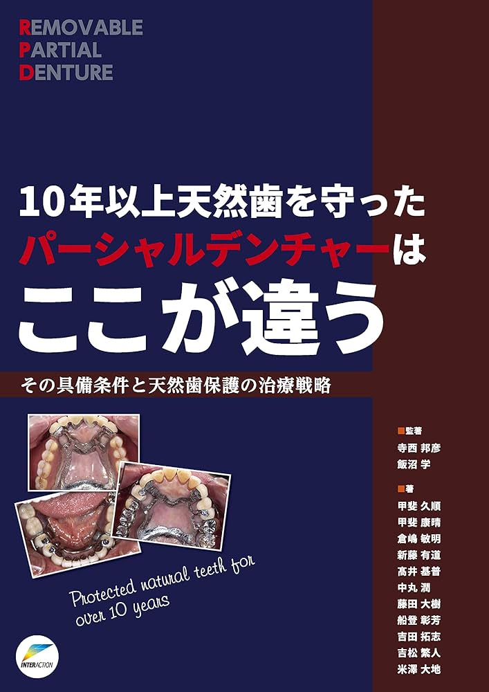 10年以上天然歯を守ったパーシャルデンチャーはここが違う: その具備