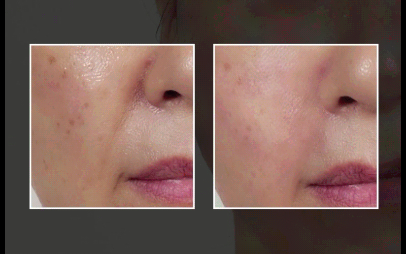 Amazon | インモトックス小顔リフトアップペプチドクリーム&吸引