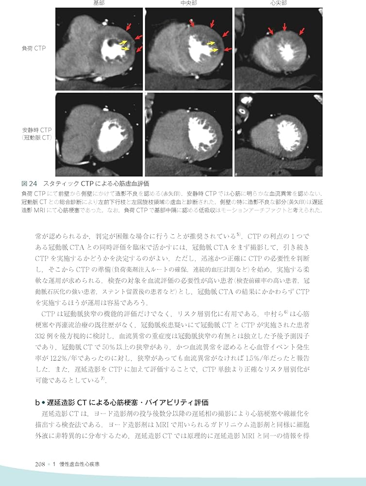 心臓疾患のCTとMRI 第2版 | 佐久間肇, 陣崎雅弘, 北川覚也, 石田正樹