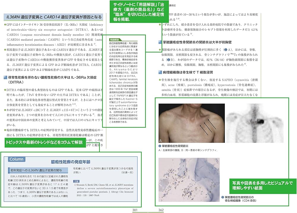 乾癬・掌蹠膿疱症 病態の理解と治療最前線 (皮膚科ベストセレクション