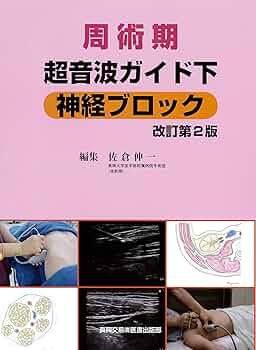 Amazon.co.jp: 周術期超音波ガイド下神経ブロック : 佐倉 伸一: 本