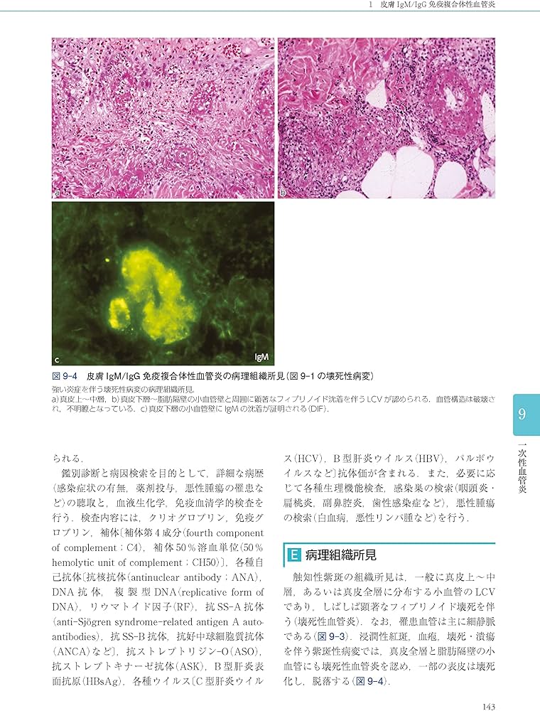Amazon.co.jp: 皮膚血管炎 第2版 : 川名 誠司, 陳 科榮: 本