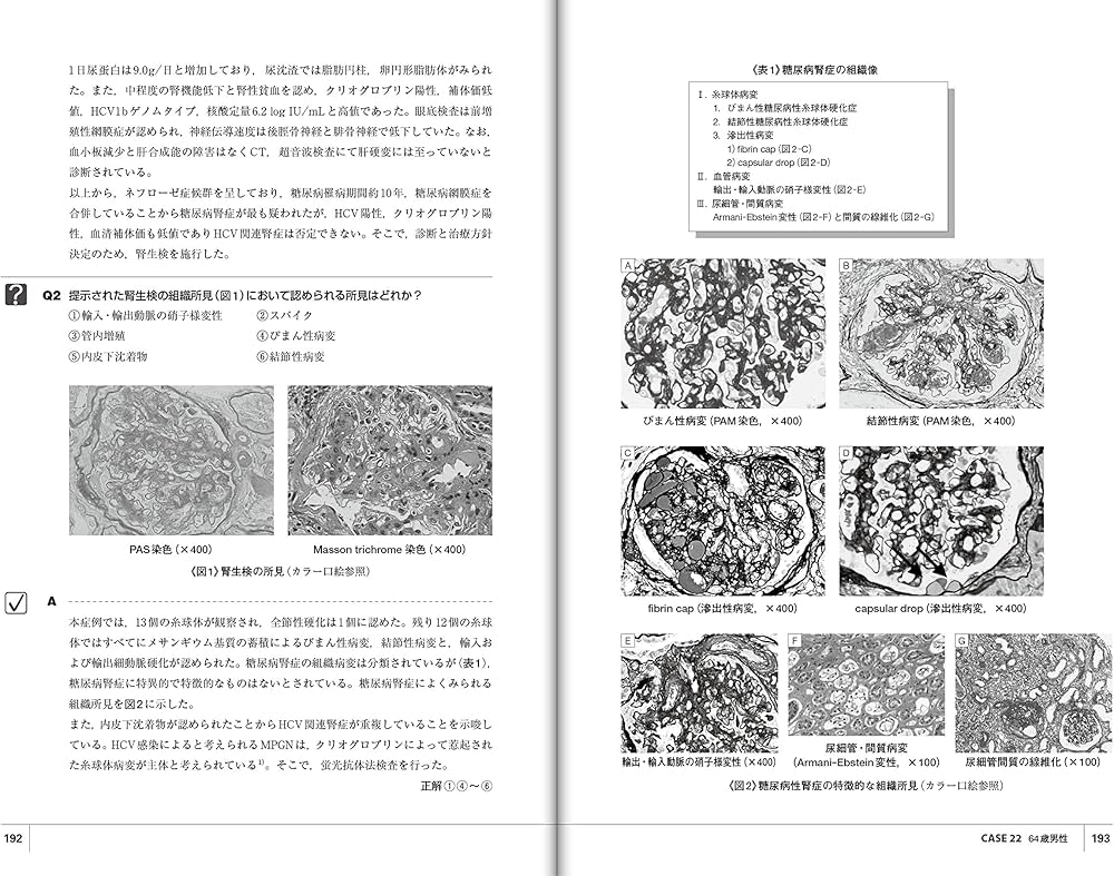 New専門医を目指すケース・メソッド・アプローチ 腎臓疾患 | 柏原 直樹