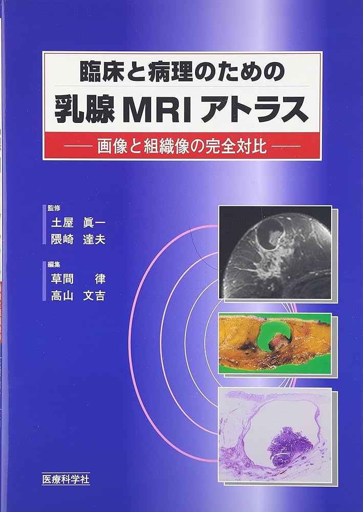 臨床と病理のための乳腺MRIアトラス | 眞一, 土屋, 達夫, 隈崎, 律