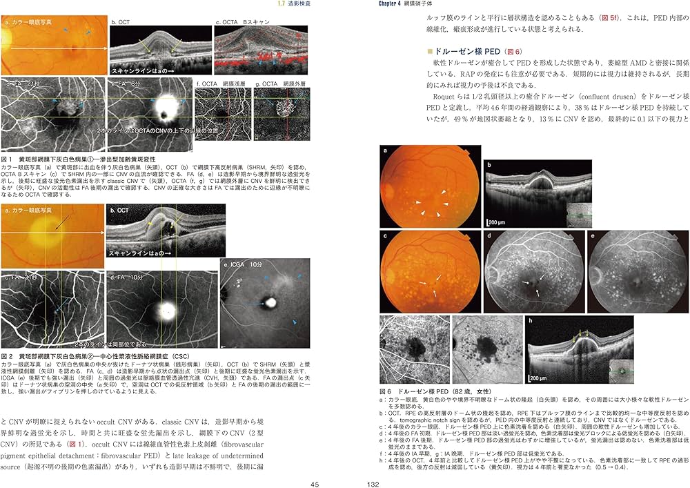 最新 眼科画像診断パワーアップ (眼科診療エクレール 2) | 辻川明孝