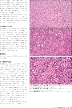 Amazon.co.jp: 脳腫瘍臨床病理カラーアトラス 第5版 : 日本脳腫瘍病理