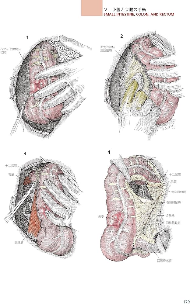 ゾリンジャー外科手術アトラス 第2版 | 安達 洋祐 |本 | 通販 | Amazon
