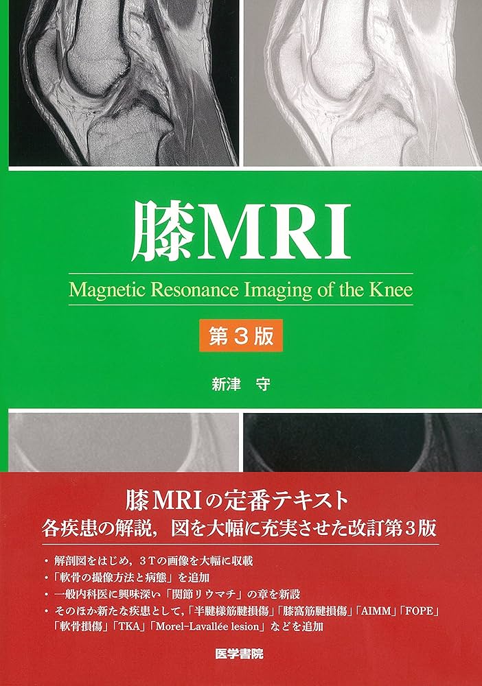 膝MRI 第3版 | 新津 守 |本 | 通販 | Amazon