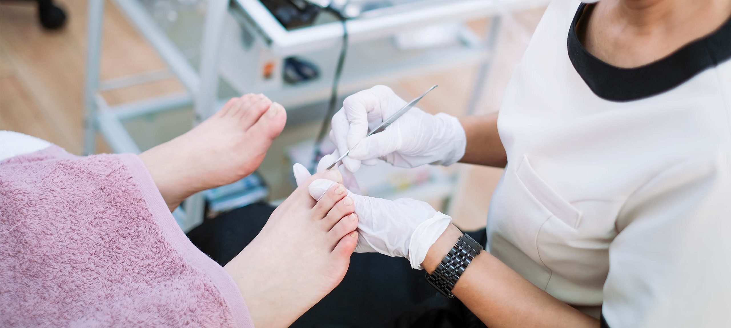 巻き爪補正ベーシックコース – 巻き爪ケア・ヨネクラ｜千葉市稲毛区