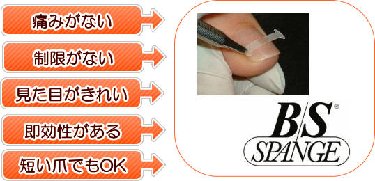巻き爪 | 痛くない!巻き爪治療 東京練馬巻き爪センター