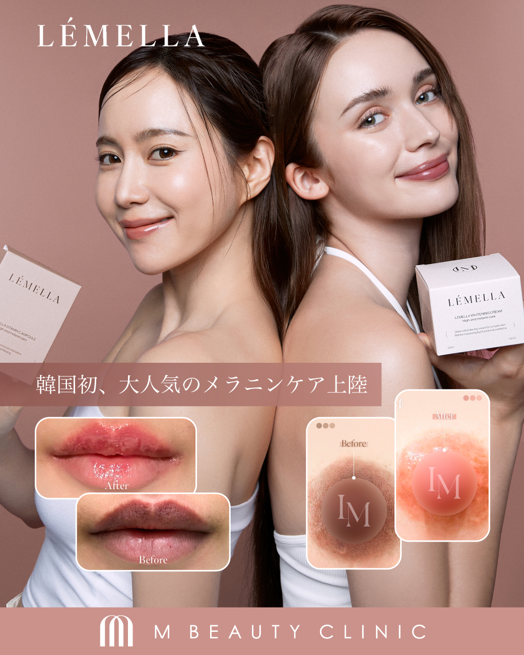 8月末まで「ルメラ（LEMELLA）導入キャンペーン」実施中！ | M BEAUTY