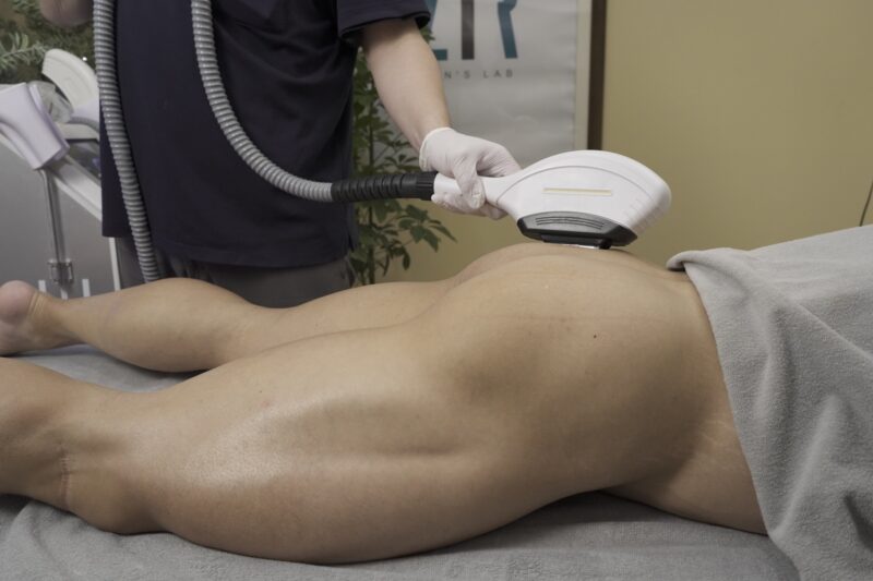 コース - 男性専用脱毛サロン Men's lab ZIR