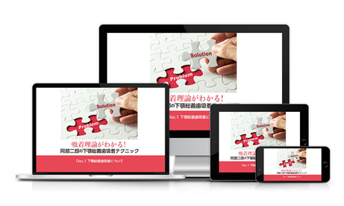 吸着理論がわかる！阿部二郎の下顎総義歯吸着テクニック | 医療情報