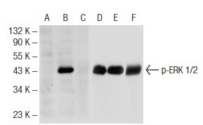 p-ERK 1/2 Antibody (12D4) | SCBT - Santa Cruz Biotechnology