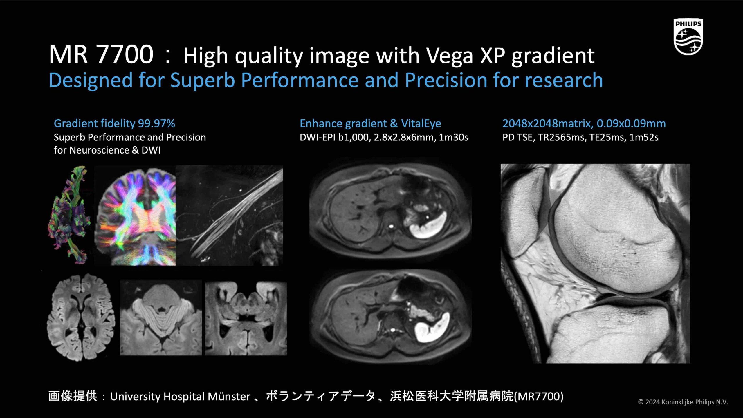 ITEM2024レポート〜Philips編〜 | MRIfan.net