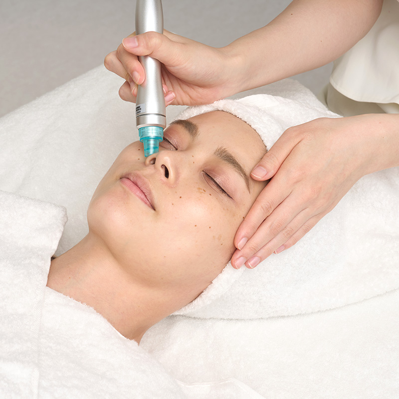 毛穴の角栓スッキリ大掃除！ミュゼの「毛穴集中 美肌ハイドラ