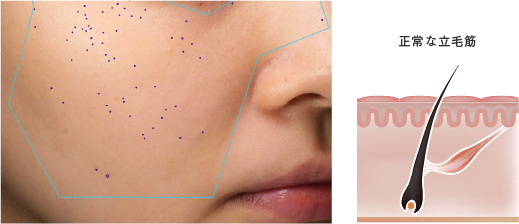 MYTREX PROVE | トータルリフト美顔器 -