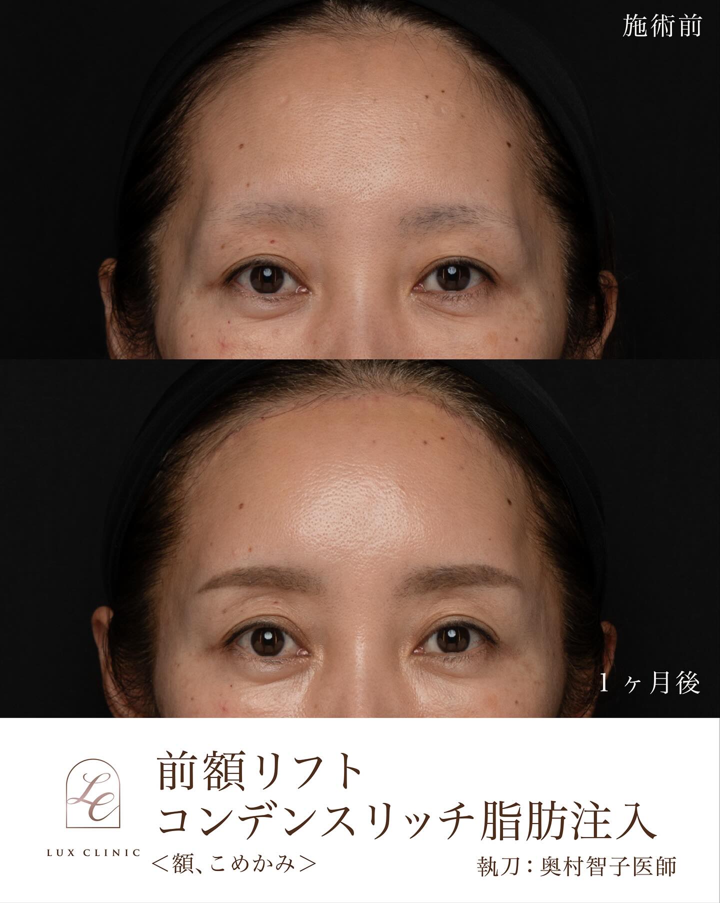 エイジングケアは何歳から？10年後を見据えた顔の育て方｜NERO DOCTOR