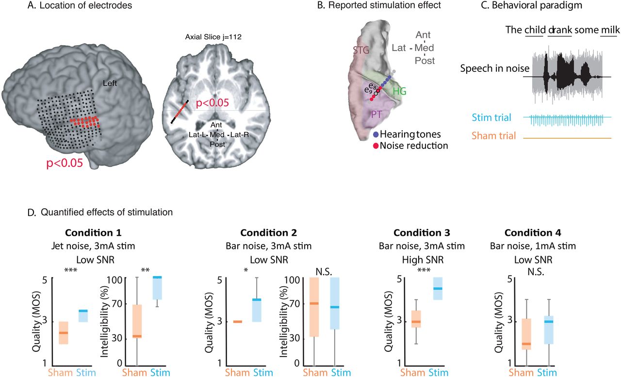 脳を電気刺激するノイズキャンセリングヘッドホンの可能性 | neumo