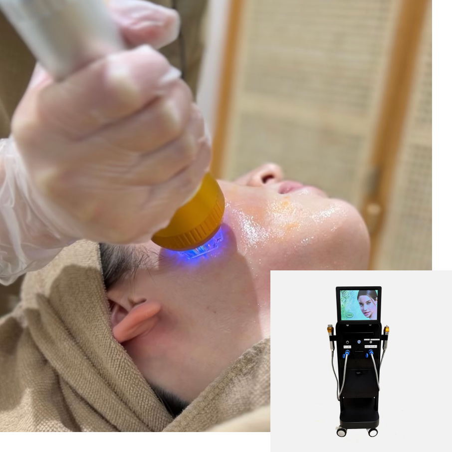 サーマジェン | 美容整形は東京 銀座 有楽町の美容外科・美容皮膚科の