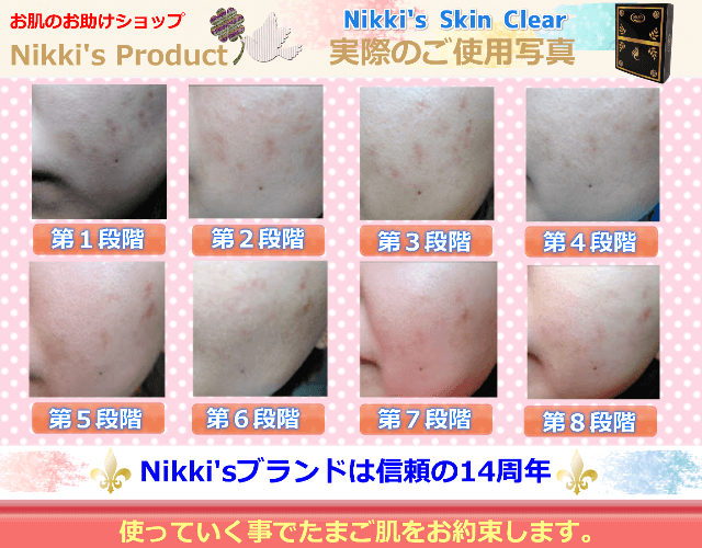 ニッキーズスキンクリア Nikki's Skin Clear 通常使用 (シミ、そばかす