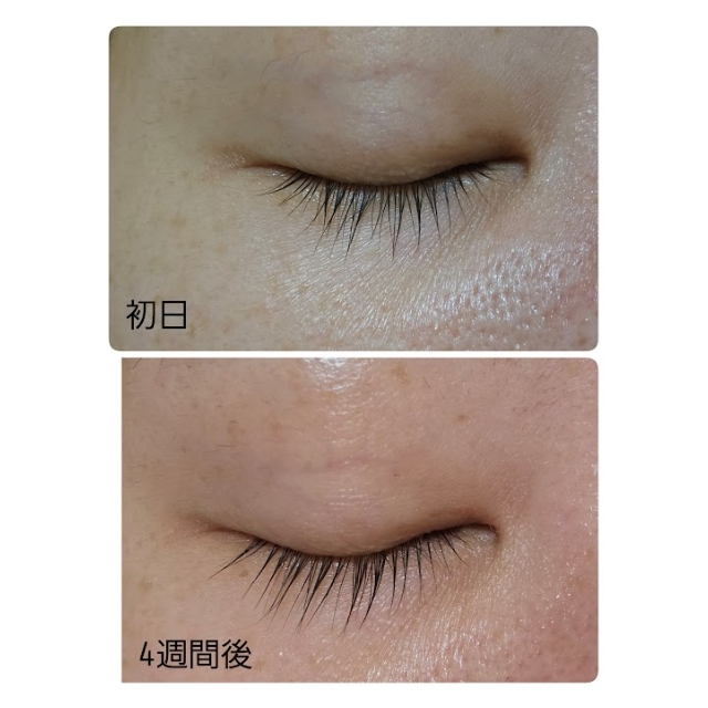 プロショット ラッシュセラム｜まつ毛美容液 | FIVE WEB STORE | 理