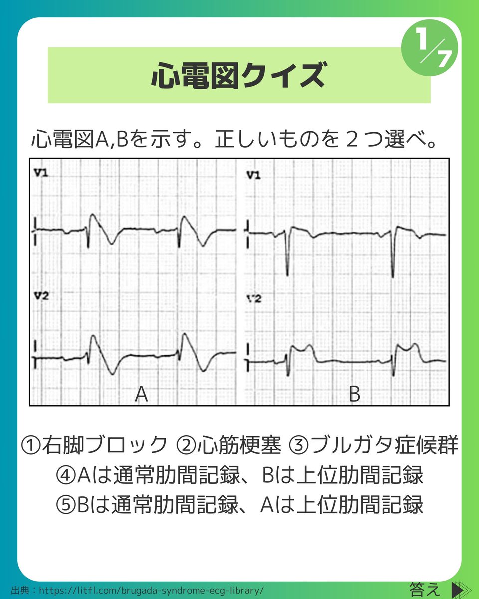 心電図検定2級対策】(1/4) 去年の検定で実際に出題された問題！ (類似