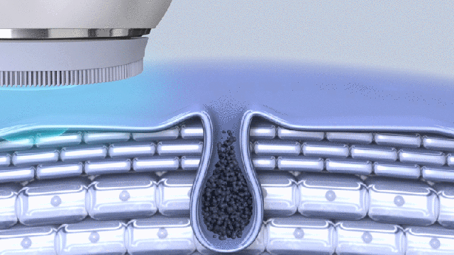 公開初日の達成率2801%】美しさを諦めない忙しい現代人へ。MIRAE音波式