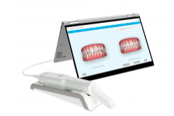 アライン・テクノロジー・ジャパン株式会社「iTero エレメント」口腔内