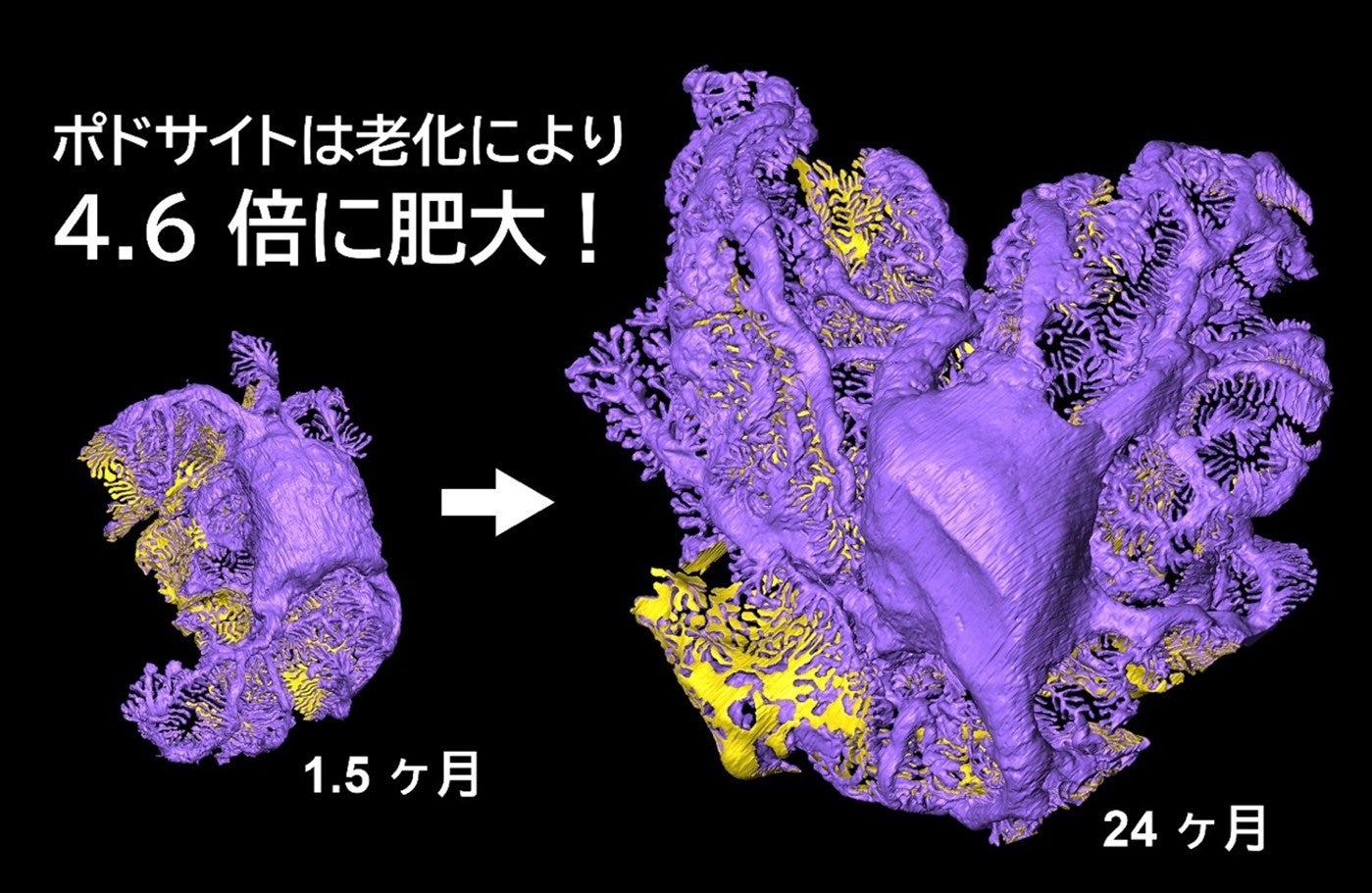 長寿命細胞ポドサイトが老化に抗い生存し、糸球体を維持するメカニズム